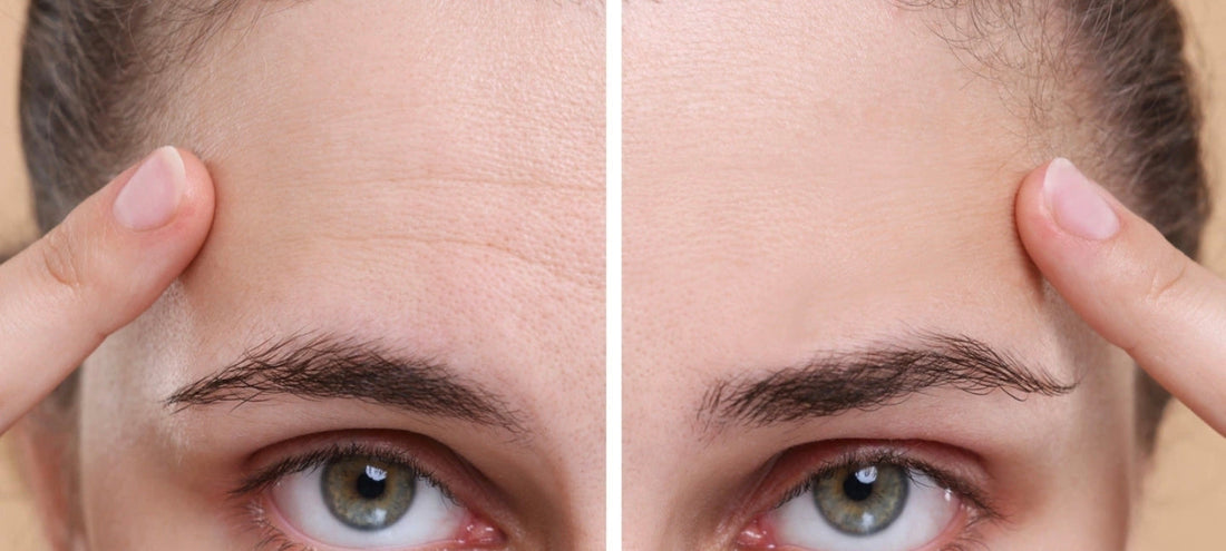 SkinCeuticals P-TIOX 2026: The Non-Invasive Botox Alternative Dominating Skincare