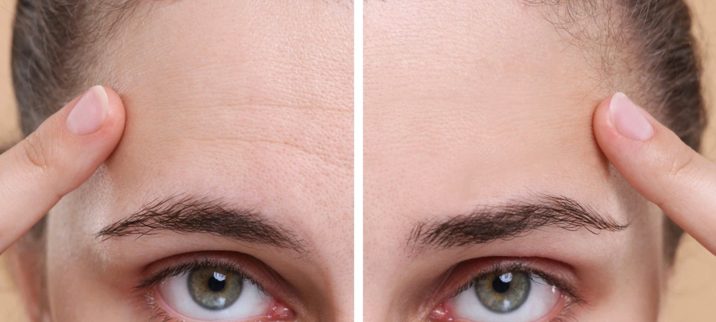 SkinCeuticals P-TIOX 2026: The Non-Invasive Botox Alternative Dominating Skincare
