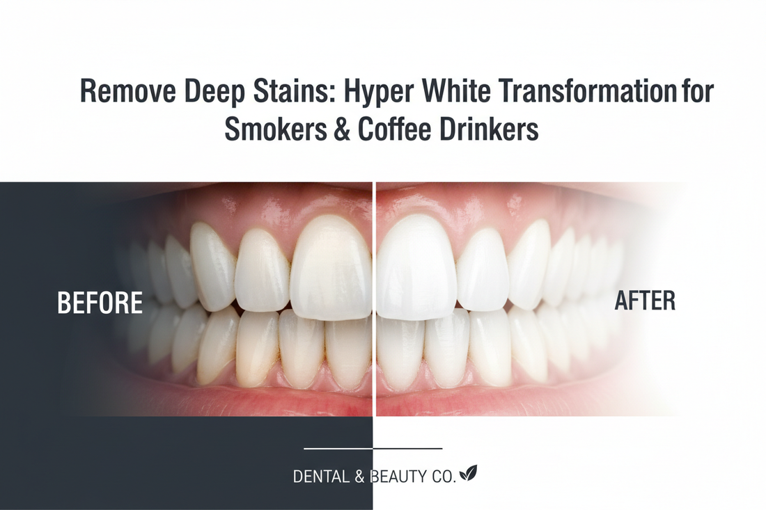 Remove Deep Stains: Hyper White Transformation for Smokers & Coffee Drinkers